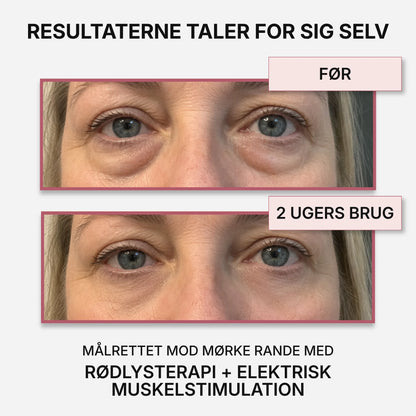 VividEyes™ 2-i-1 Rødlysterapi + EMS til at fjerne mørke rande